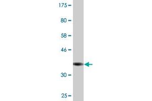 Western Blot detection against Immunogen (35. (Recoverin antibody  (AA 91-181))