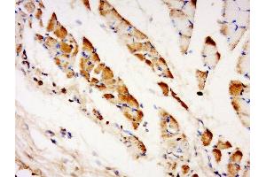 Paraformaldehyde-fixed, paraffin embedded human muscle tissue, Antigen retrieval by boiling in sodium citrate buffer (pH6) for 15min, Block endogenous peroxidase by 3% hydrogen peroxide for 30 minutes, Blocking buffer (normal goat serum) at 37°C for 20min, Antibody incubation with TXLNB Polyclonal Antibody, Unconjugated  at 1:500 overnight at 4°C, followed by a conjugated secondary and DAB staining. (Taxilin beta antibody  (AA 331-430))