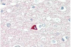 Image no. 2 for anti-Synaptosomal-Associated Protein, 25kDa (SNAP25) (AA 151-200) antibody (ABIN2879129) (SNAP25 antibody  (AA 151-200))