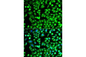 Immunofluorescence analysis of A549 cells using ALKBH4 antibody. (ALKBH4 antibody)