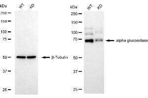 Western blotting analysis using alpha glucosidase antibody (ABIN7797585).