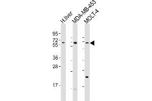 All lanes : Anti-OPN-a/b Antibody (N-term) at 1:1000 dilution Lane 1: human liver lysates Lane 2: MDA-MB-453 whole cell lysates Lane 3: MOLT-4 whole cell lysates Lysates/proteins at 20 μg per lane. (OPN-A,b (AA 14-40), (N-Term) antibody)