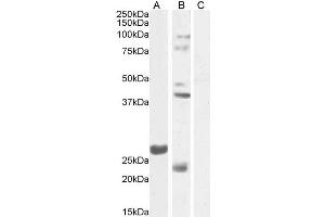 ABIN768639 (1µg/ml) staining of Mouse Testes lysate 1 (A) and Testes lysate 2 (B) + peptide (C) (35µg protein in RIPA buffer). (FGF23 antibody  (Internal Region))