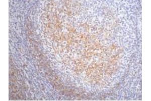 Immunohistochemistry (IHC) image for anti-Fc Fragment of IgE, Low Affinity II, Receptor For (CD23) (FCER2) antibody (ABIN3181119) (FCER2 antibody)