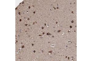 Immunohistochemical staining of human cerebral cortex with ODZ1 polyclonal antibody  shows strong cytoplasmic positivity in neuronal cells at 1:10-1:20 dilution. (ODZ1/Teneurin 1 antibody)