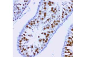 Anti-MCAK antibody, (ABIN3043278), IHC(P)IHC(P): Rat Testis Tissue (KIF2C antibody  (AA 531-725))