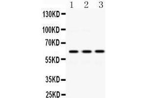 Western Blotting (WB) image for anti-Crossover junction endonuclease EME1 (EME1) (AA 520-561), (C-Term) antibody (ABIN3042370)