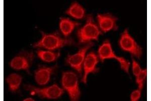Immunofluorescence (fixed cells) (IF/ICC) image for anti-Pyrimidinergic Receptor P2Y, G-Protein Coupled, 6 (P2RY6) (C-Term) antibody (ABIN6263952)