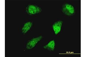 Immunofluorescence of monoclonal antibody to HOXD11 on HeLa cell. (HOXD11 antibody  (AA 1-76))