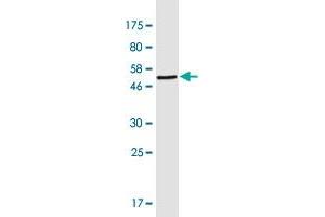 Western Blot detection against Immunogen (49. (CRYbB2 antibody  (AA 1-205))