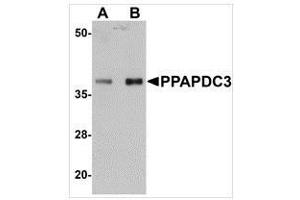 Western blot analysis of PPAPDC3 in mouse heart tissue lysate with PPAPDC3 antibody at (A) 1 and (B) 2 μg/ml.