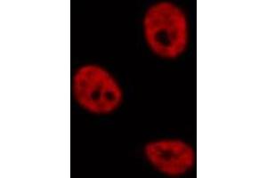 ABIN6276858 staining  MCF7 cells by IF/ICC. (POLR2E antibody  (Internal Region))