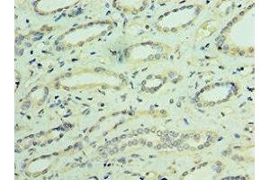 Immunohistochemistry of paraffin-embedded human kidney tissue using ABIN7172887 at dilution of 1:100 (TRPV4 antibody  (AA 1-230))