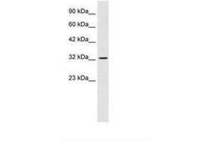 Image no. 2 for anti-SWI/SNF Related, Matrix Associated, Actin Dependent Regulator of Chromatin, Subfamily A, Member 2 (SMARCA2) (AA 58-107) antibody (ABIN6736031) (SMARCA2 antibody  (AA 58-107))