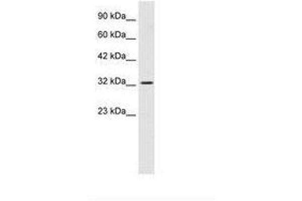 SMARCA2 antibody  (AA 58-107)