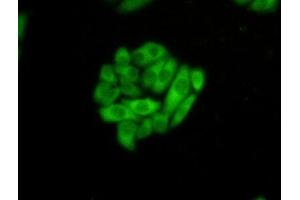 Detection of HSPA1L in Hela cells using Polyclonal Antibody to Heat Shock 70 kDa Protein 1 Like Protein (HSPA1L) (HSPA1L antibody  (AA 1-641))