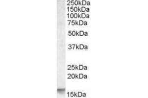 Western Blotting (WB) image for anti-Phorbol-12-Myristate-13-Acetate-Induced Protein 1 (PMAIP1) (Internal Region) antibody (ABIN2475926) (NOXA antibody  (Internal Region))