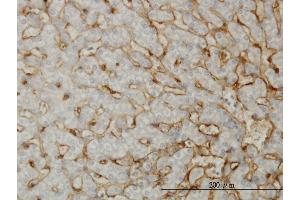 Immunoperoxidase of monoclonal antibody to EHD3 on formalin-fixed paraffin-embedded human liver. (EHD3 antibody  (AA 357-406))