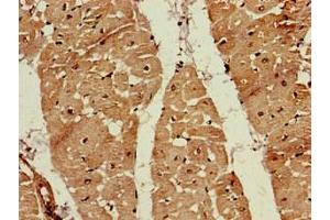 Immunohistochemistry of paraffin-embedded human heart tissue using ABIN7152571 at dilution of 1:100 (FDPS antibody  (AA 1-419))