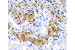 Immunohistochemistry of paraffin-embedded Mouse kidney using HPD Polyclonal Antibody at dilution of 1:100 (40x lens). (HPD antibody)