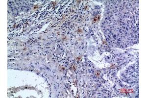 Immunohistochemistry (IHC) analysis of paraffin-embedded Human Lung, antibody was diluted at 1:100. (IREM1 antibody  (Internal Region))