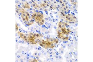 Immunohistochemistry of paraffin-embedded mouse kidney using HPD antibody at dilution of 1:100 (x40 lens). (HPD antibody)