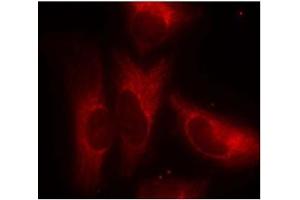 Image no. 3 for anti-14-3-3 zeta (YWHAZ) (pSer58) antibody (ABIN196916) (14-3-3 zeta antibody  (pSer58))