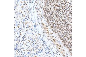 Immunohistochemistry of paraffin-embedded rat ovary using Nucleolin Rabbit mAb (ABIN7269035) at dilution of 1:25 (40x lens). (Nucleolin antibody)