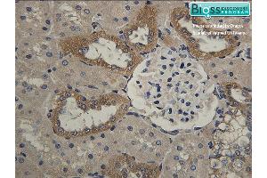 Immunohistochemistry (IHC) image for anti-Hydroxysteroid (11-Beta) Dehydrogenase 2 (HSD11B2) (AA 151-250) antibody (ABIN701680)