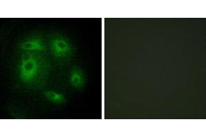 Peptide - +Immunohistochemistry analysis of paraffin-embedded human prostate carcinoma tissue, using DLEC1 antibody. (DLEC1 antibody)