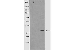 Western blot analysis of XBP1 expression in HepG2 cell lysate,The lane on the left is treated with the antigen-specific peptide. (XBP1 antibody  (C-Term))