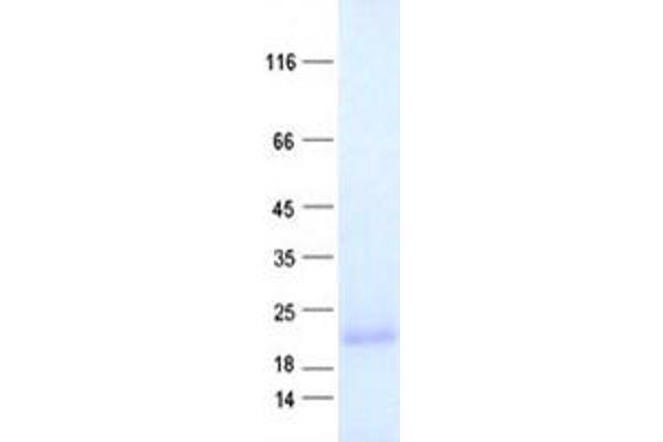 C3orf24 Protein (His tag)