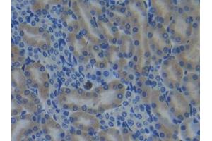 IHC-P analysis of Mouse Kidney Tissue, with DAB staining. (CYP26A1 antibody  (AA 250-495))