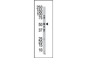 Western blot analysis of anti-MOK Pab in A375 cell lysate. (RAGE antibody  (C-Term))