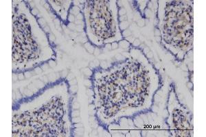 Immunoperoxidase of monoclonal antibody to MPHOSPH9 on formalin-fixed paraffin-embedded human small Intestine. (MPHOSPH9 antibody  (AA 922-1031))