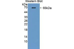 Detection of Recombinant MAOA, Rat using Polyclonal Antibody to Monoamine Oxidase A (MAOA) (Monoamine Oxidase A antibody  (AA 2-497))