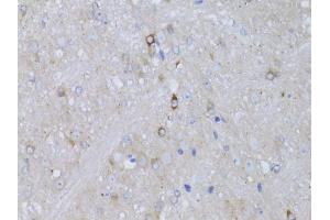Immunohistochemistry of paraffin-embedded mouse brain using RARA antibody (ABIN5970142) at dilution of 1/100 (40x lens). (Retinoic Acid Receptor alpha antibody)