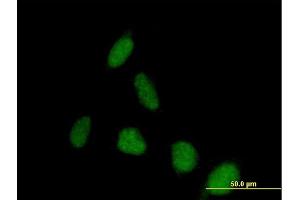 Immunofluorescence of purified MaxPab antibody to PSD on HeLa cell. (PSD antibody  (AA 1-1024))