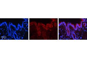 CALR antibody - C-terminal region (ARP30114_P050) Catalog Number: ARP30114_P050  Formalin Fixed Paraffin Embedded Tissue: Human Bronchial Epithelial Tissue  Observed Staining: Cytoplasm and membrane of bronchial epithelial tissue Primary Antibody Concentration: 1:100 Secondary Antibody: Donkey anti-Rabbit-Cy3  Secondary Antibody Concentration: 1:200  Magnification: 20X  Exposure Time: 0. (Calreticulin antibody  (C-Term))