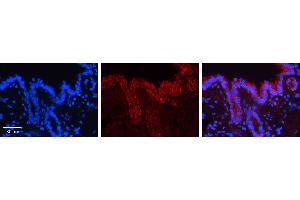 CALR antibody - C-terminal region (ARP30114_P050) Catalog Number: ARP30114_P050  Formalin Fixed Paraffin Embedded Tissue: Human Bronchial Epithelial Tissue  Observed Staining: Cytoplasm and membrane of bronchial epithelial tissue Primary Antibody Concentration: 1:100 Secondary Antibody: Donkey anti-Rabbit-Cy3  Secondary Antibody Concentration: 1:200  Magnification: 20X  Exposure Time: 0. (Calreticulin antibody  (C-Term))