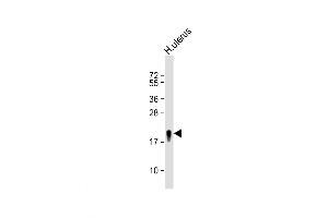 Western Blot at 1:8000 dilution + H. (Transgelin antibody  (N-Term))