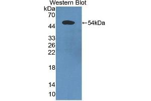Western Blotting (WB) image for anti-Programmed Cell Death 6 Interacting Protein (PDCD6IP) (AA 174-383) antibody (ABIN1869717) (ALIX antibody  (AA 174-383))