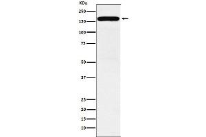 Western blot analysis of DIAPH1 expression in K562 cell lysate. (Recombinant DIAPH1 antibody)