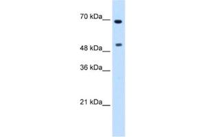 Western Blotting (WB) image for anti-Myc Proto-Oncogene protein (MYC) antibody (ABIN2460542) (c-MYC antibody)