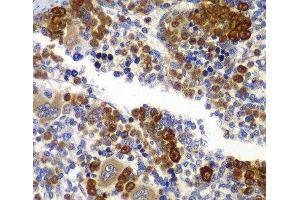 Immunohistochemistry of paraffin-embedded Rat spleen using PRKAB1 Polyclonal Antibody at dilution of 1:100 (40x lens). (PRKAB1 antibody)