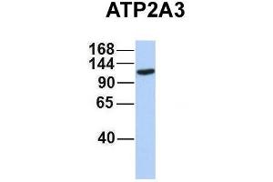 Host:  Rabbit  Target Name:  ATP2A3  Sample Type:  MCF7  Antibody Dilution:  1. (ATP2A3 antibody  (Middle Region))