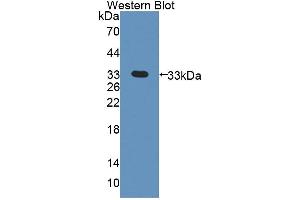 Western blot analysis of the recombinant protein. (PDK3 antibody  (AA 138-396))