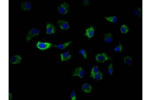 Immunofluorescence staining of MCF7 Cells with ABIN7127572 at 1:50, counter-stained with DAPI. (Recombinant ILK antibody)
