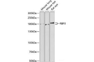 Western blot analysis of extracts of various cell lines using RBP3 Polyclonal Antibody at dilution of 1:1000. (RBP3 antibody)