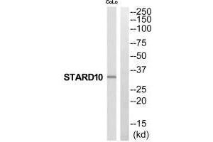 Western blot analysis of extracts from COLO205 cells, using STARD10 antibody. (STAR antibody  (N-Term))